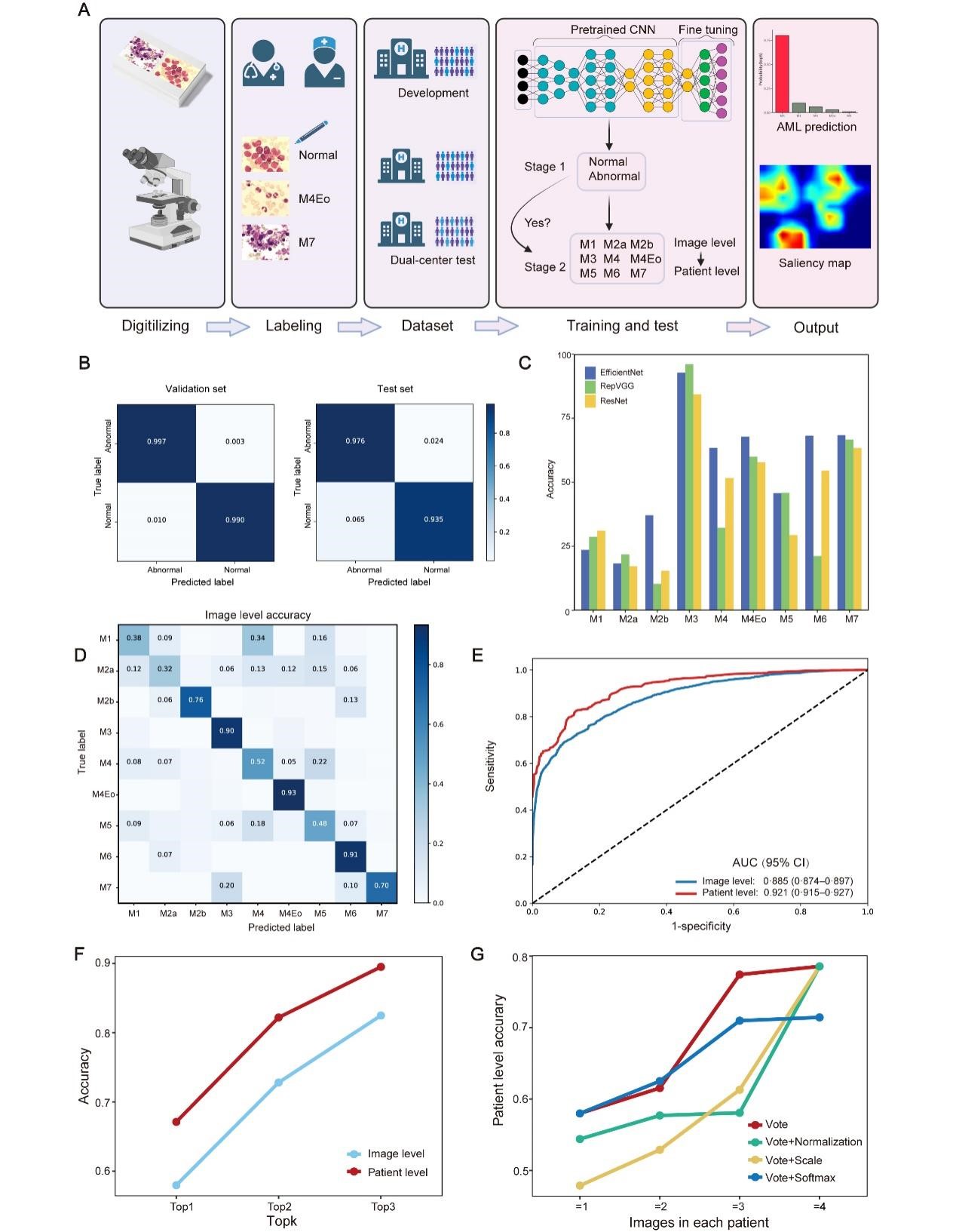 Deep learning assists in acute myeloid leukemia diagnosis