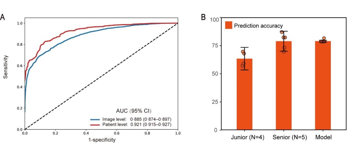 Deep learning assists in acute myeloid leukemia diagnosis