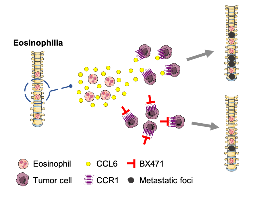 The Role Eosinophils Play In Cancer