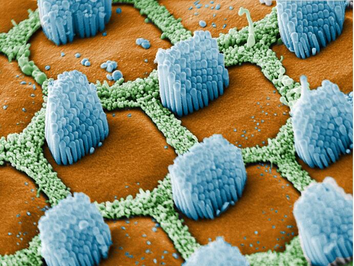 科学封面(第18期)—— neuron: 为何千分之二的人听不见?