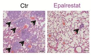 Epalrestat inhibits lung metastases of mice.jpg